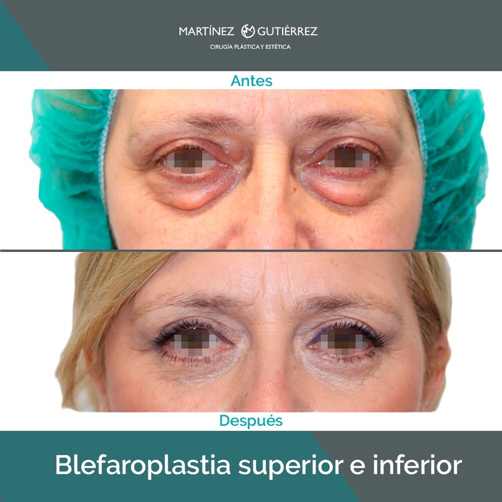 Clinic Results Gallery